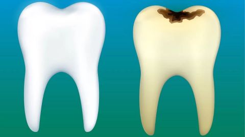 تغذیه و محافظت از دندان